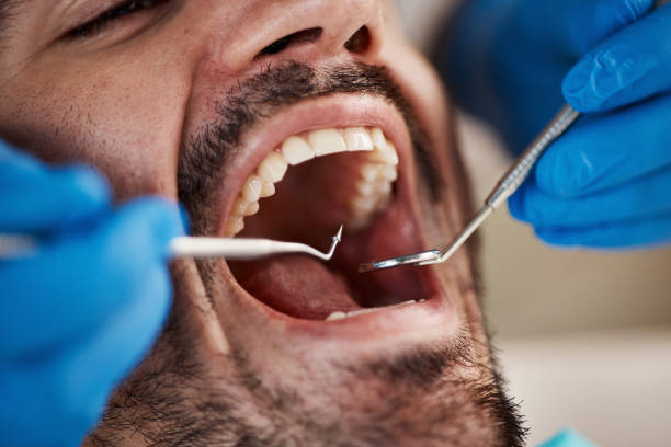 Best Chipped Tooth Repair Near Me  in Pine Castle, FL
