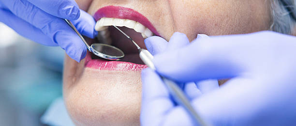 Best Broken Tooth Emergency  in Pine Castle, FL